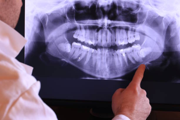 Best Emergency Treatment for Dental Infections or Abscesses in Salineville, OH