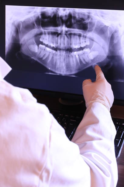 Best Emergency Dental Care for Broken or Chipped Teeth in Salineville, OH