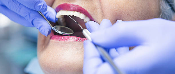 Best Urgent Care for Lost Fillings or Crowns in Salineville, OH